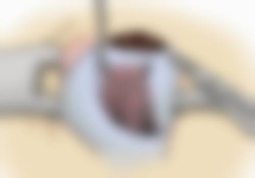 深圳市安洲眼科门诊部特色项目及技术优势