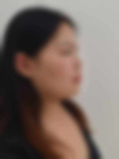 芙莱思整形外科是正规的吗