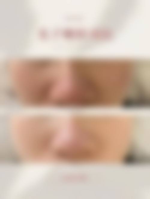 为什么要选择金昌市中医和西医结合医院整形美容科?