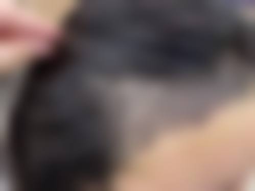 温州伊美尔加禾植发连锁机构怎么样预约挂号