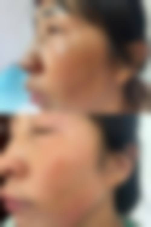 昆山花度蜜美医疗美容门诊部口碑怎么样