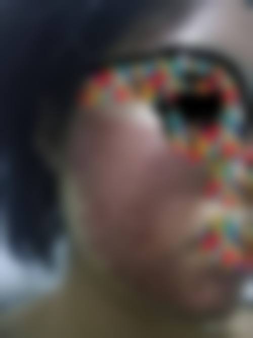 北京春语医疗美容医院口碑怎么样