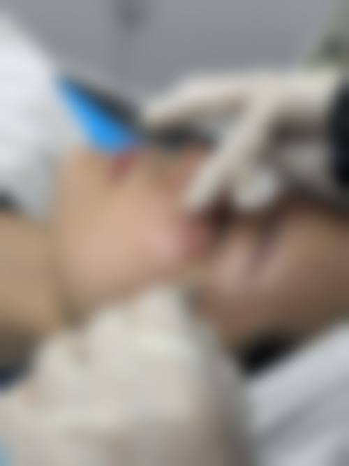 北京春语医疗美容医院收费价格表