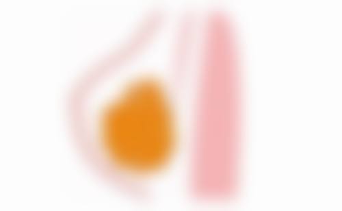 长沙华研皮肤病医院口碑怎么样