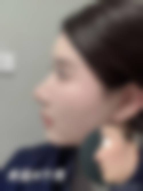 为什么要选择江门颜禧美汇整形医院?