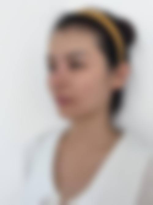 为什么要选择淮北天香医疗整形医学美容医院（原张英医疗美容整形医院）？