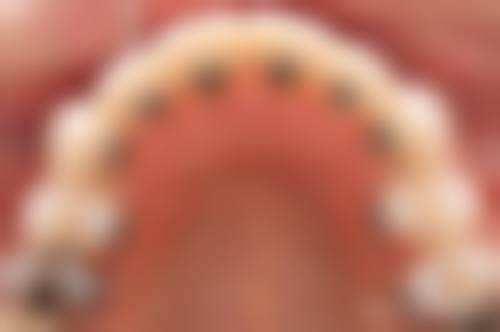 为什么要选择浙江杭州淳爱口腔门诊部？