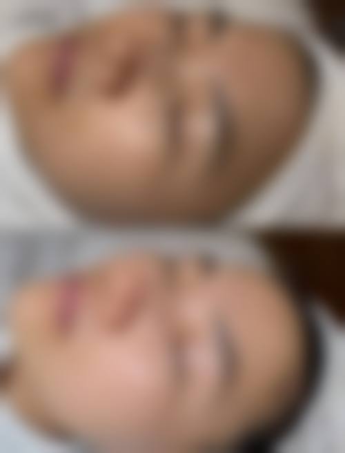 江门颜禧美汇整形医院收费价格表