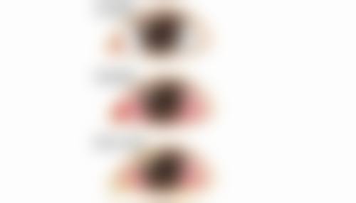 恩施爱尔眼科医院是正规的吗