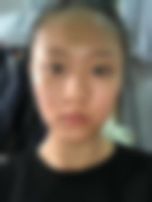 武汉健丽整形医院是正规的吗/怎么样/靠谱吗