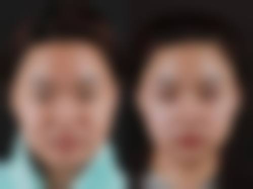 为什么要选择武汉健丽整形医院?