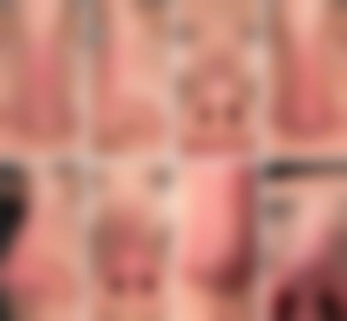 为什么要选择哈尔滨美佰玥医疗美容门诊部?