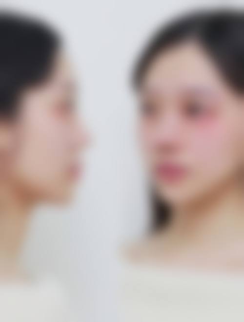 哈尔滨美佰玥医疗美容门诊部口碑怎么样