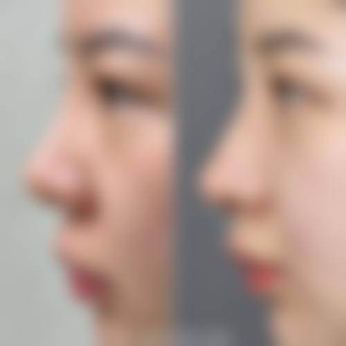 韩国face-line整形医院怎么样预约挂号