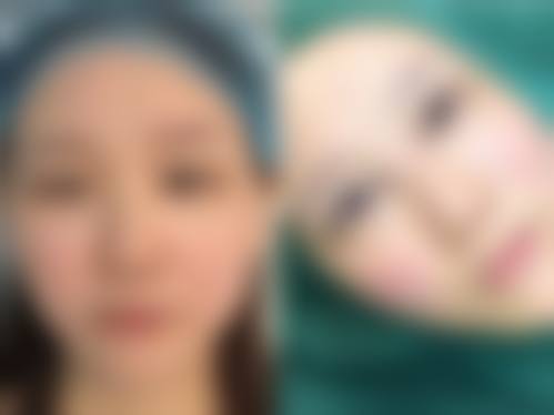 福建优医联合医疗美容医院怎么样预约挂号