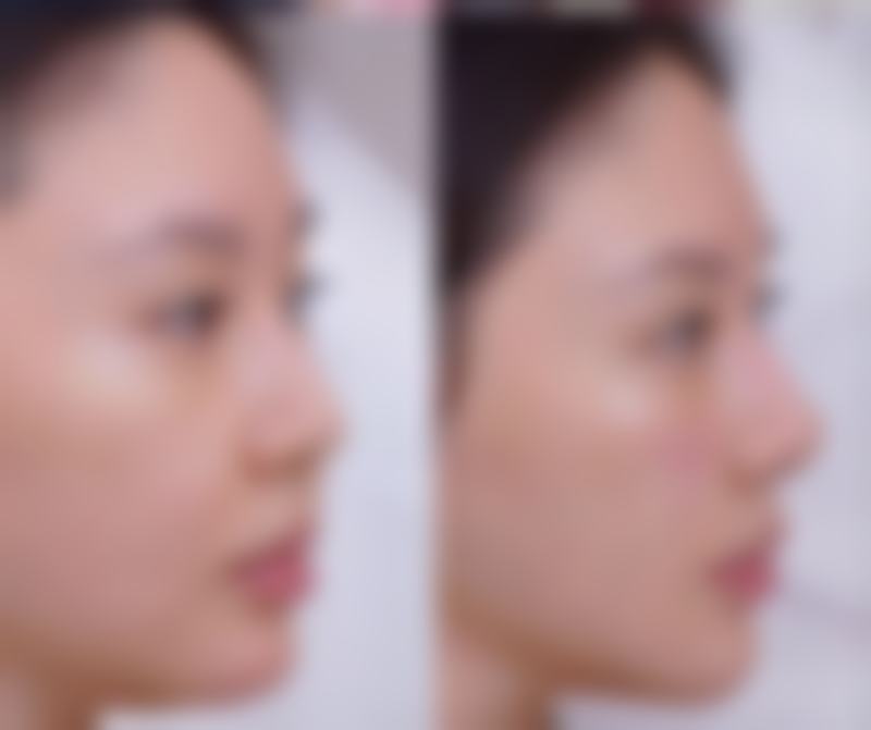 哈尔滨美佰玥医疗美容门诊部收费价格表