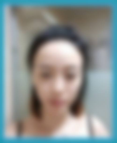 金华李建放医疗美容诊所怎么样预约挂号
