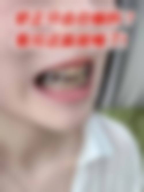 福建三明沙县贝恩口腔收费价格表