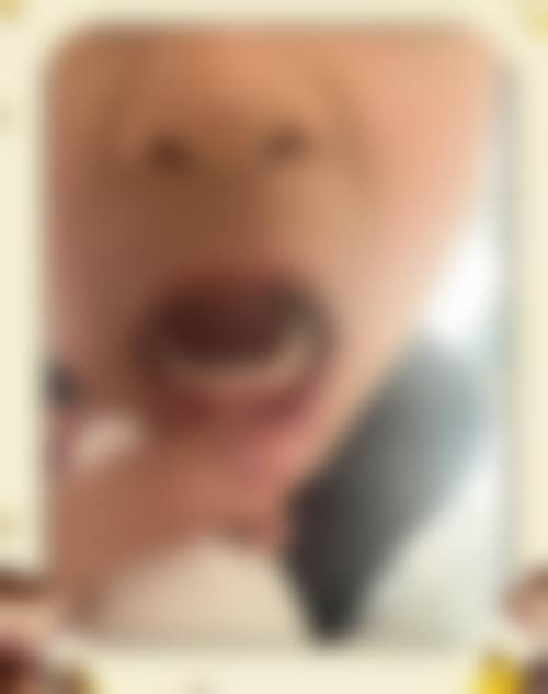 临床实战与真实实例