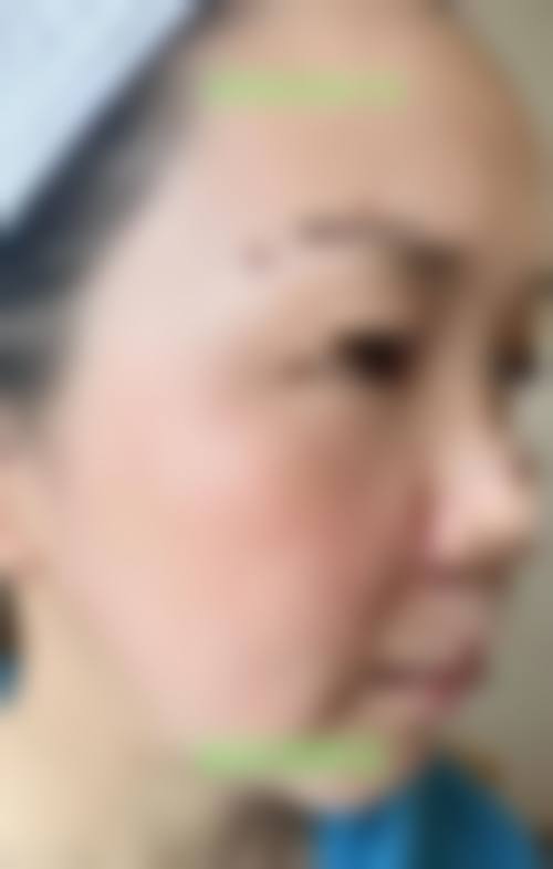 上海颜术高得医疗美容门诊部口碑怎么样