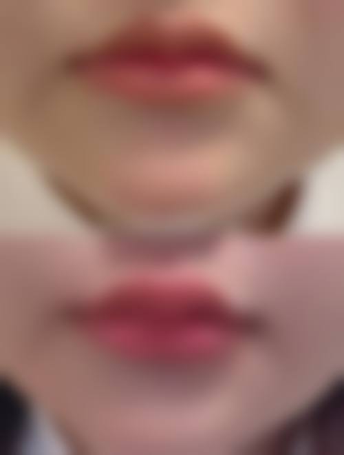 为什么要选择银川艾伊医学美容诊所?