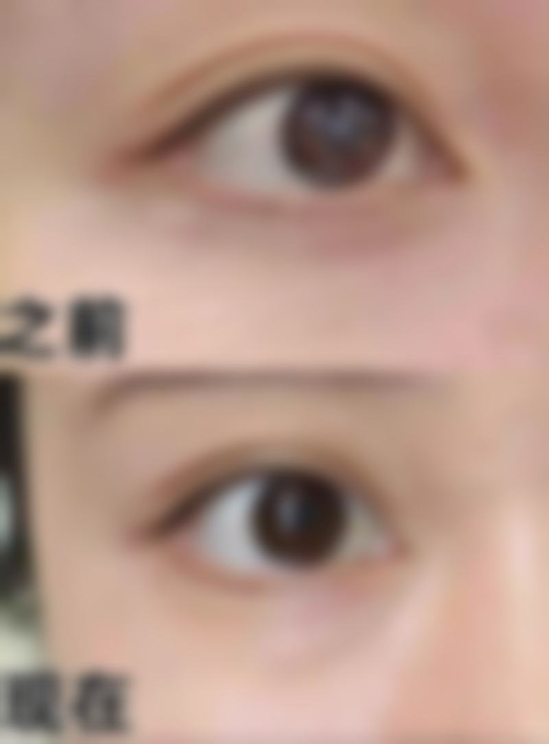湖州森雅医疗美容门诊部是正规的吗/怎么样/靠谱吗