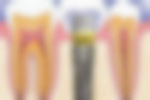 长沙瑞泰科尔雅口腔连锁怎么样预约挂号