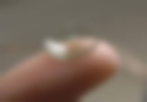 深圳多视点眼科门诊部特色项目及技术优势