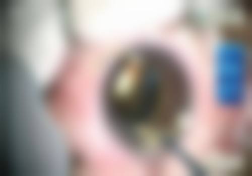深圳多视点眼科门诊部口碑怎么样