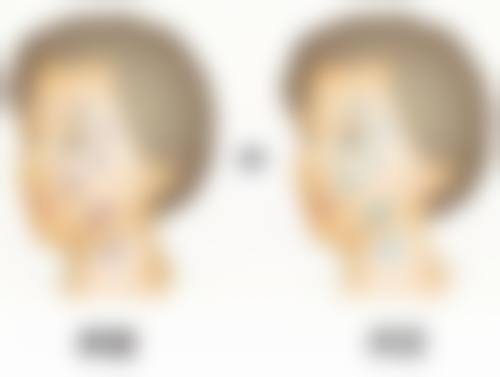 杭州优医惠整形医院特色项目及技术优势
