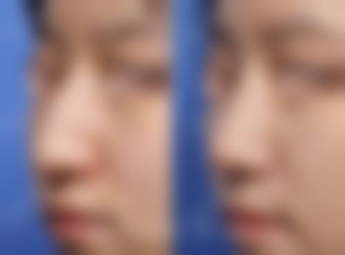 龙文碧湖新医美医疗美容诊所交通路线攻略