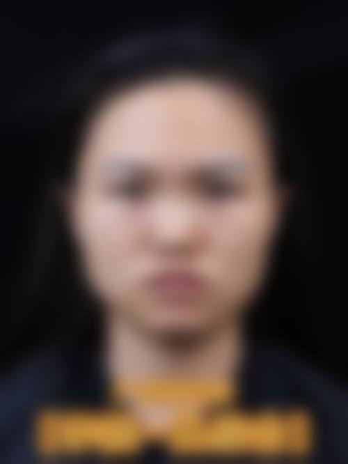 为什么要选择定边县梵洛辰整形医院?