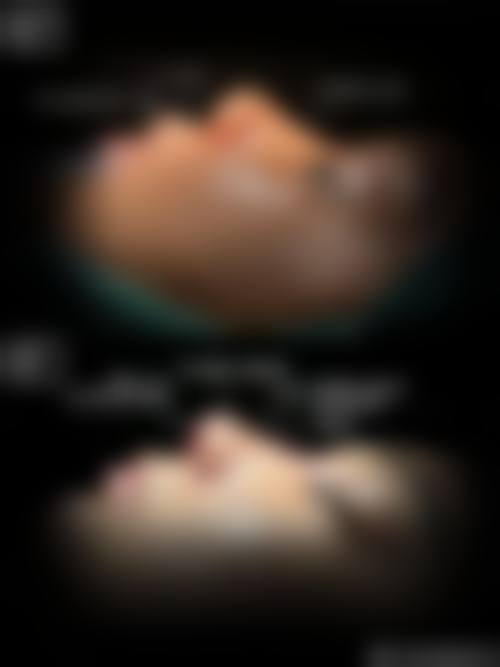三、临床实战与真实实例
