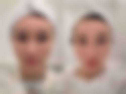 3. 罗曼丽的临床实战与真实实例
