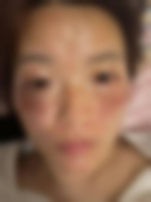 益阳市人民医院医学美容整形科口碑怎么样