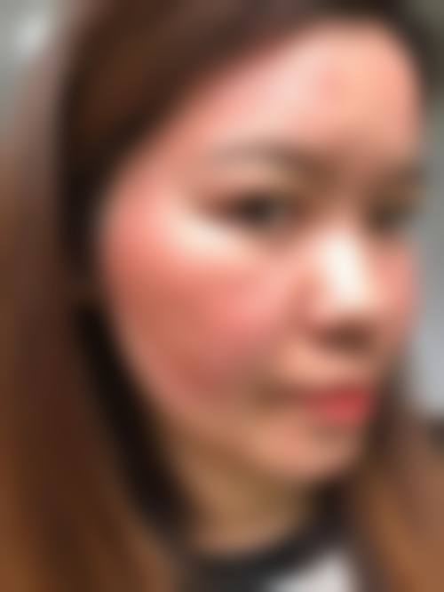 益阳市人民医院医学美容整形科收费价格表