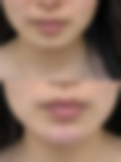 湖州德清锦上美整形医院收费价格表