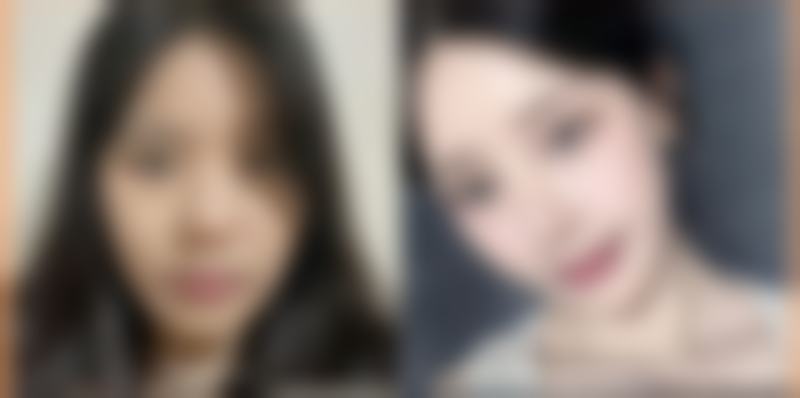 为什么要选择益阳市人民医院医学美容整形科?