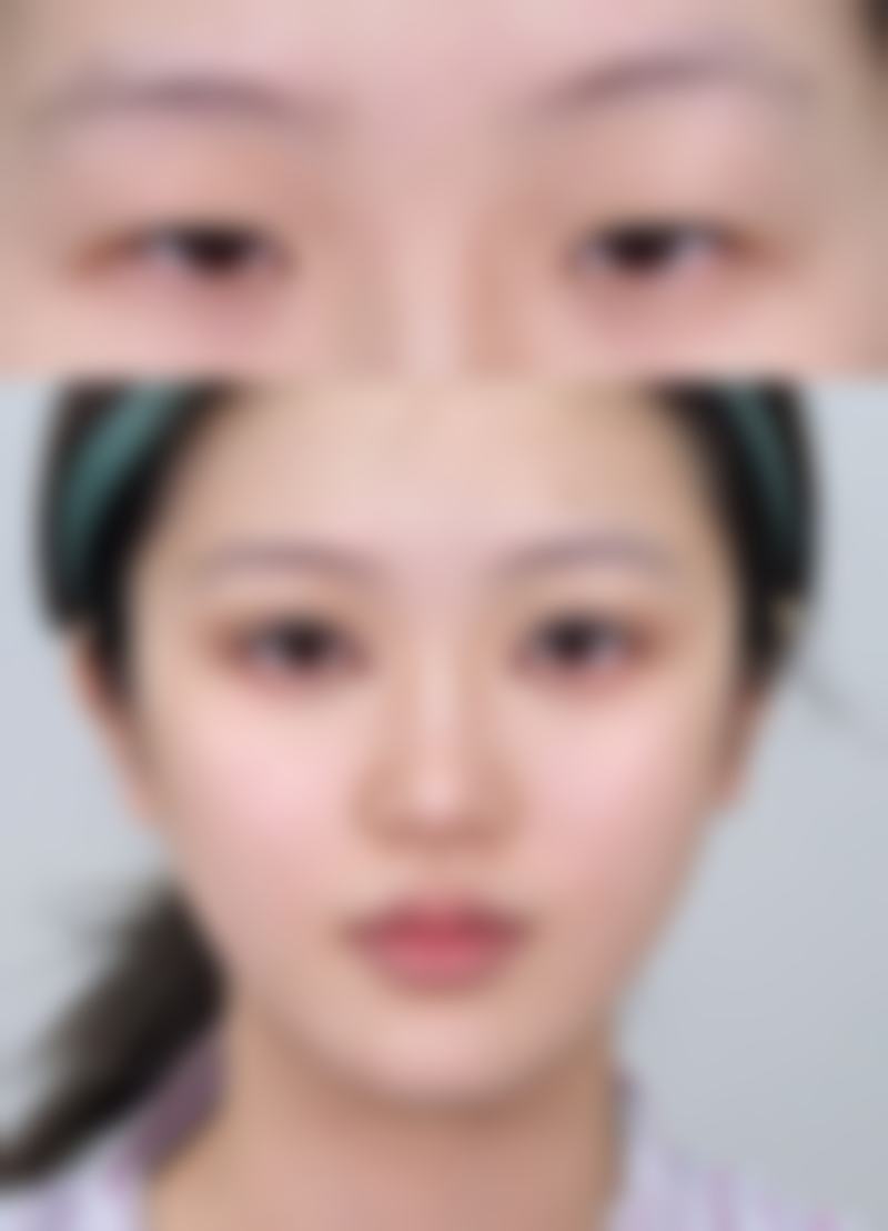 杭州优医惠整形医院是正规的吗/怎么样/靠谱吗(三选一即可)
