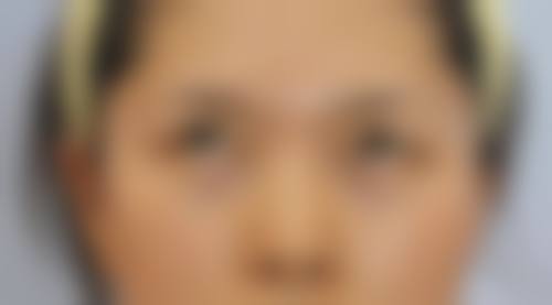 郭东云的临床实战与真实实例