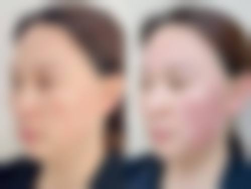 重庆禾美整形医院特色项目及技术优势