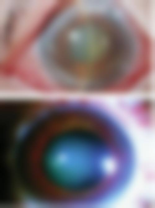 3. 刘观华的临床实战与真实实例