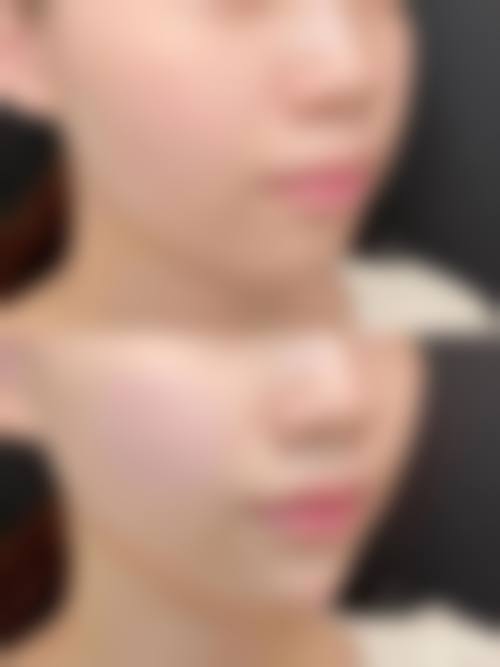 为什么要选择杭州东方整形美容门诊部?