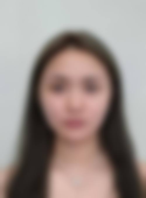杭州东方整形美容门诊部是正规的吗