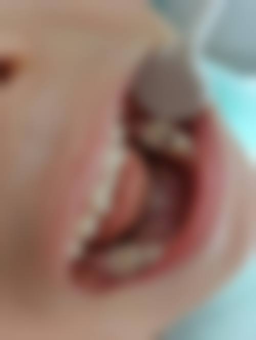 为什么要选择西安碑林齐贝口腔?