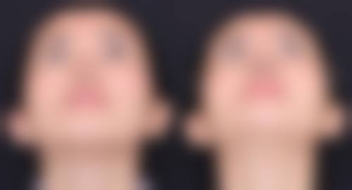 3. 马飞的临床实战与真实实例