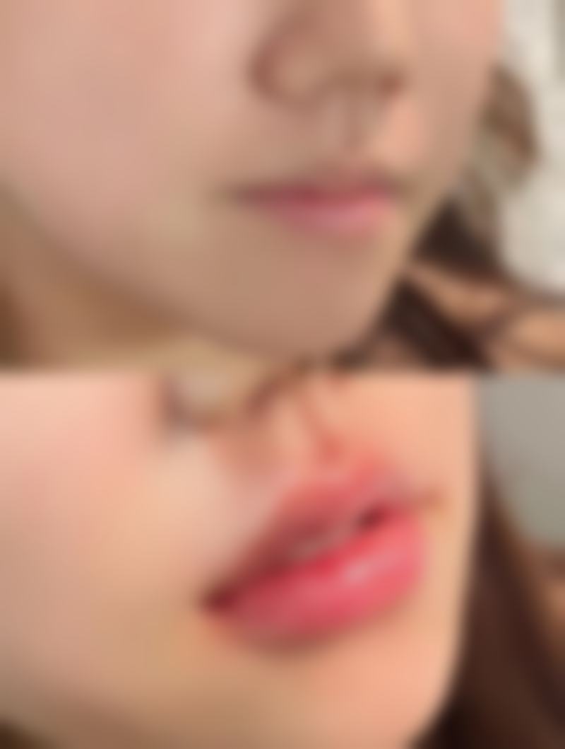 杭州耀然医疗美容诊所是正规的吗/怎么样/靠谱吗