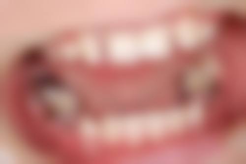 为什么要选择同济大学附属口腔医院口腔种植科?