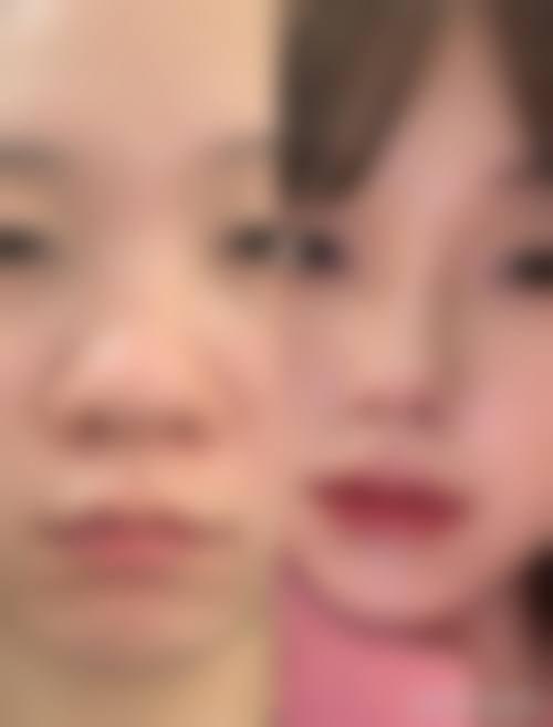 襄阳新艾伊尔整形医院是正规的吗