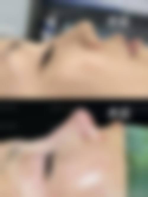 三、临床实战与真实实例